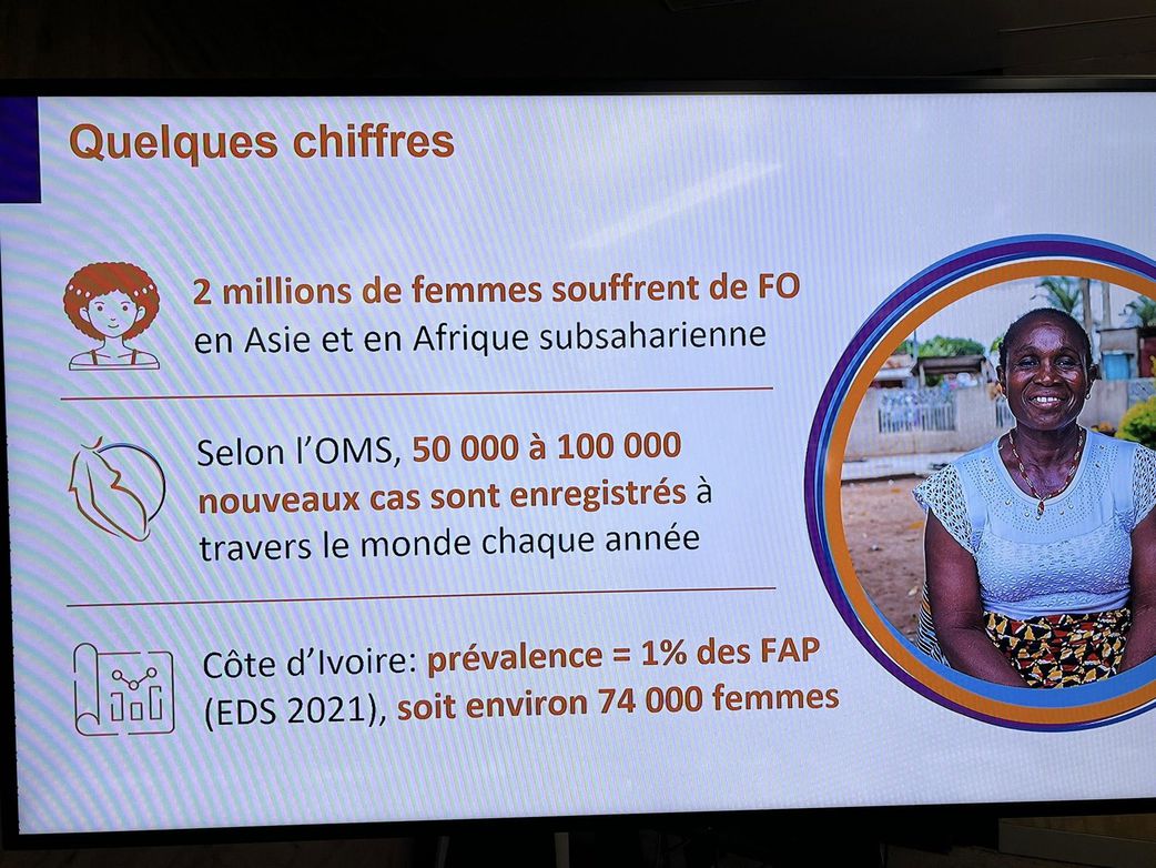 Ce qu'il faut savoir sur la fistule obstétricale, cette maladie honteuse pour les femmes