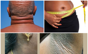 10 warning signs your body might be heading towards diabetes