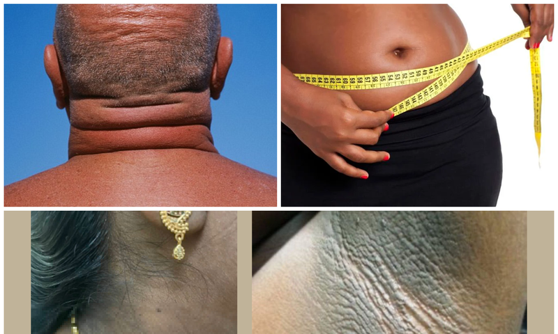 10 warning signs your body might be heading towards diabetes
