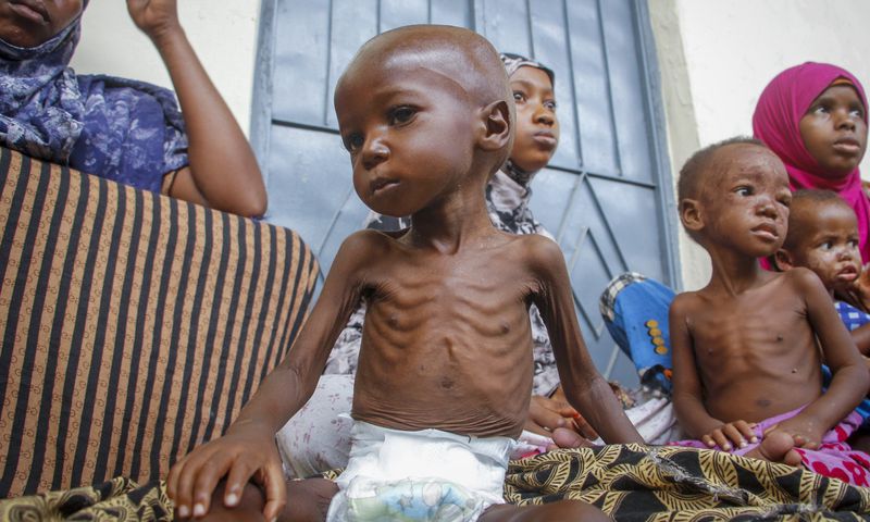 Nigeria has the most malnourished children in Africa — 2nd globally [Daily Sabah]