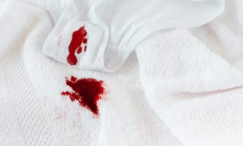 Blood stains on sheets are something almost every woman has had to deal with [MneL'Ovary]
