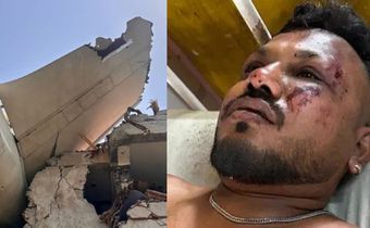 Vishwash Kumar Ramesh, the only confirmed survivor of the Air Indian crash