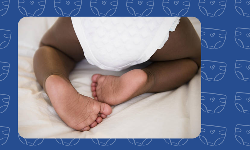 How to Treat Diaper Rash on Your Baby