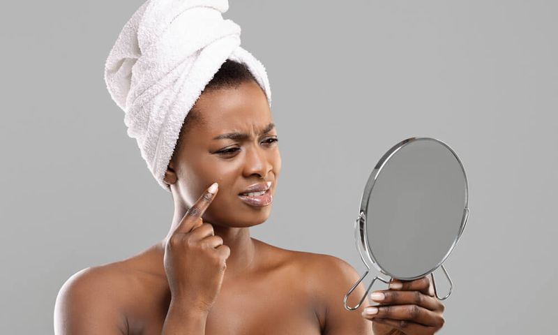 Some skin care hacks can actually do more harm than good [VineVera]
