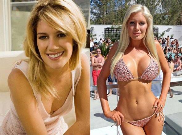 Heidi Montag before and after [HauteLiving]