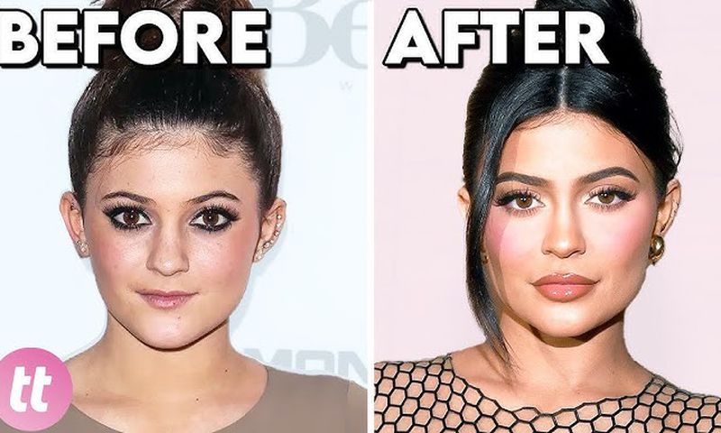 Celebs whose plastic surgery transformed them completely [YouTube]