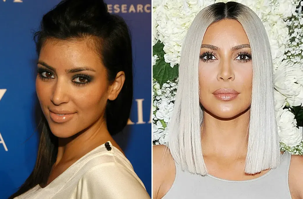 Kim Kardashian before and after [RdarOnline]