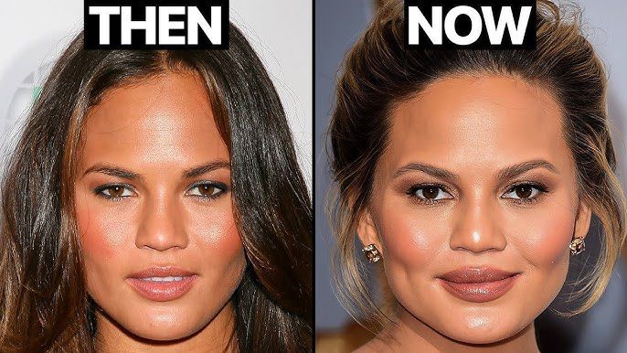 Chrissy Teigen before and after [YouTube]