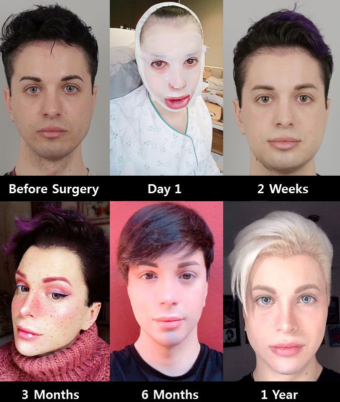 Luis's progress [Pinterest]