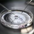 The IVF process is a form of assisted reproductive technology (ART) where an egg is fertilised outside the body, typically in a laboratory.