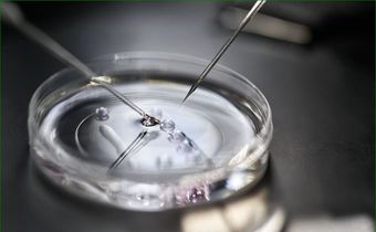 The IVF process is a form of assisted reproductive technology (ART) where an egg is fertilised outside the body, typically in a laboratory.