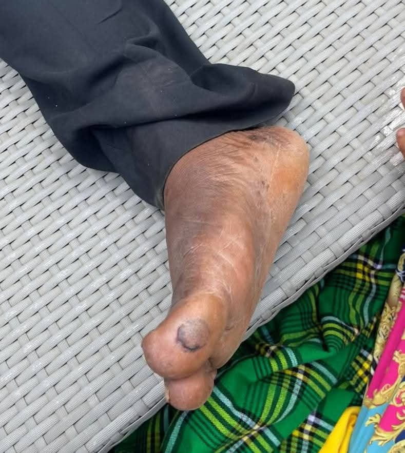 Chairman Nyanzi says he was tortured in detention
