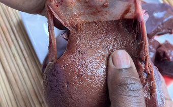 Removing the liver membrane