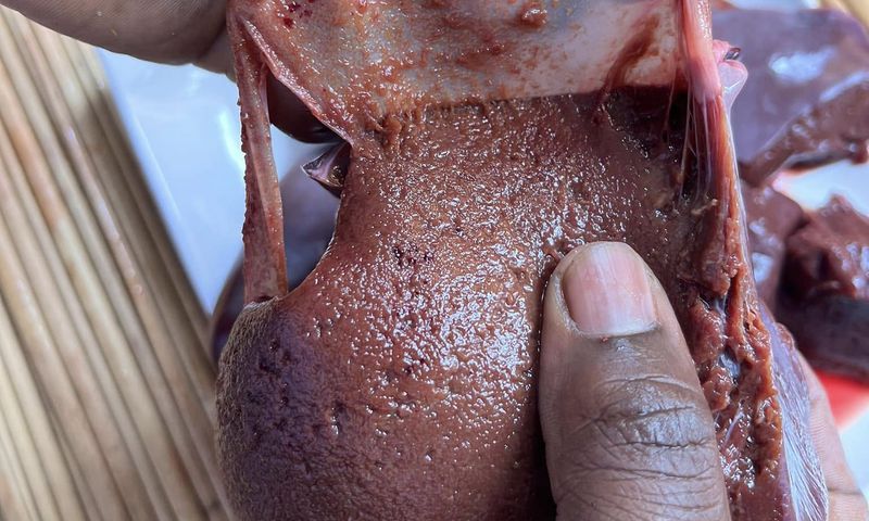 Removing the liver membrane