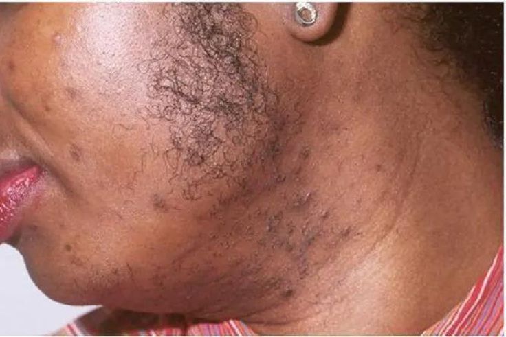 Image-d illustration