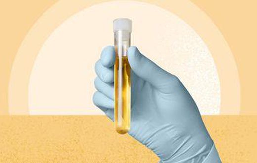 we-finally-know-why-pee-is-yellow-1440x810