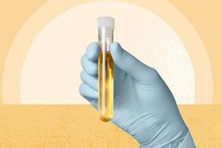 we-finally-know-why-pee-is-yellow-1440x810