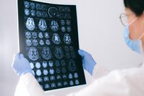 Un médécin analyse le scanner cérébral d'un patient / Anna Shvets