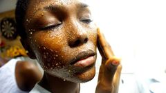 Une exfoliation excessive entraîne une sécheresse, une sensibilité et une inflammation de la peau