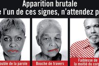 Les signes d'AVC/DR
