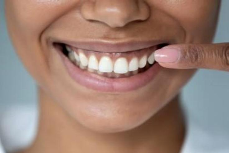 Dentition