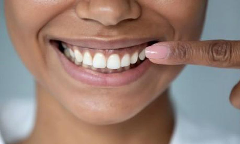 Dentition
