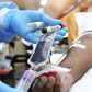 Transfusion sanguine