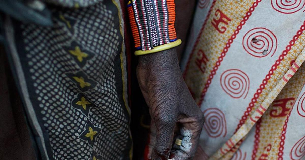 5 pays qui pratiquent encore les mutilations génitales féminines ...
