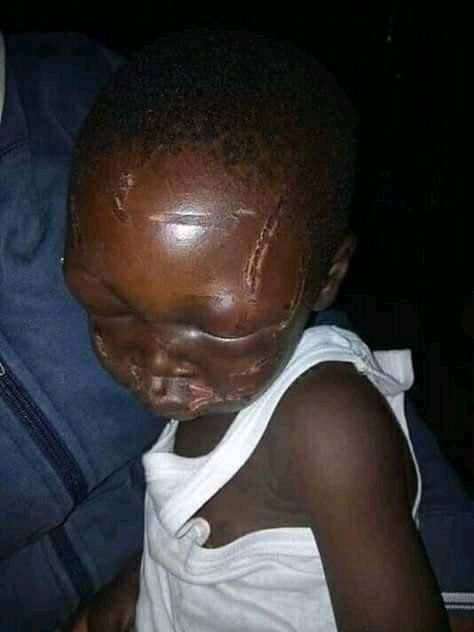 Stepmother brutalises little boy, photos will shake you