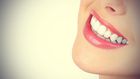 White teeth gives a brighter smile