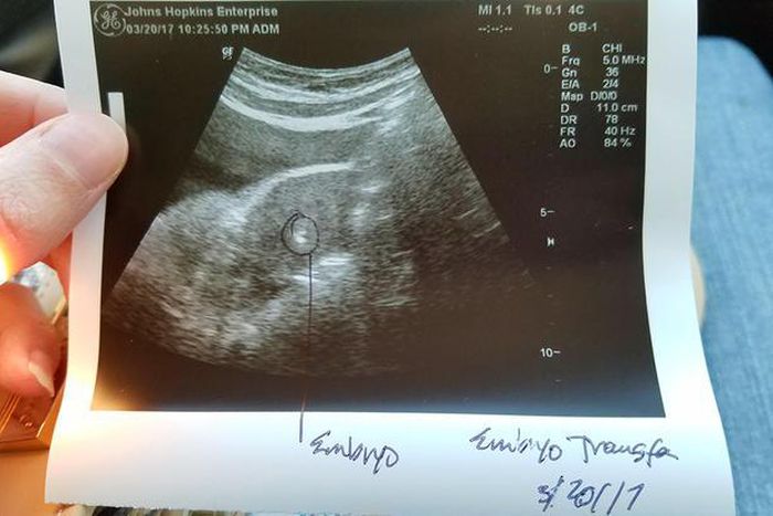 ___7065560___https:______static.pulse.com.gh___webservice___escenic___binary___7065560___2017___7___28___18___embryopicannabeard