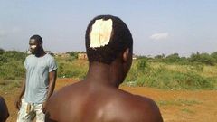 Two of the injured persons