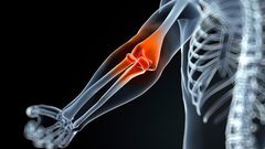 ___7140687___https:______static.pulse.com.gh___webservice___escenic___binary___7140687___2017___8___13___18___joint-pain-myth-lie