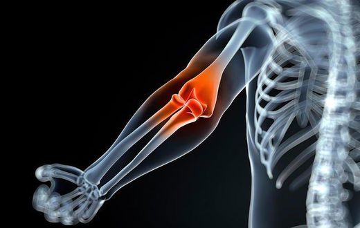 ___7140687___https:______static.pulse.com.gh___webservice___escenic___binary___7140687___2017___8___13___18___joint-pain-myth-lie