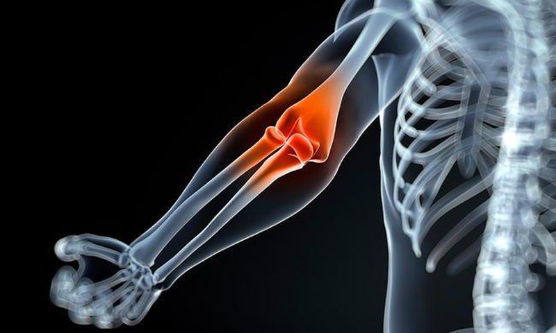 ___7140687___https:______static.pulse.com.gh___webservice___escenic___binary___7140687___2017___8___13___18___joint-pain-myth-lie