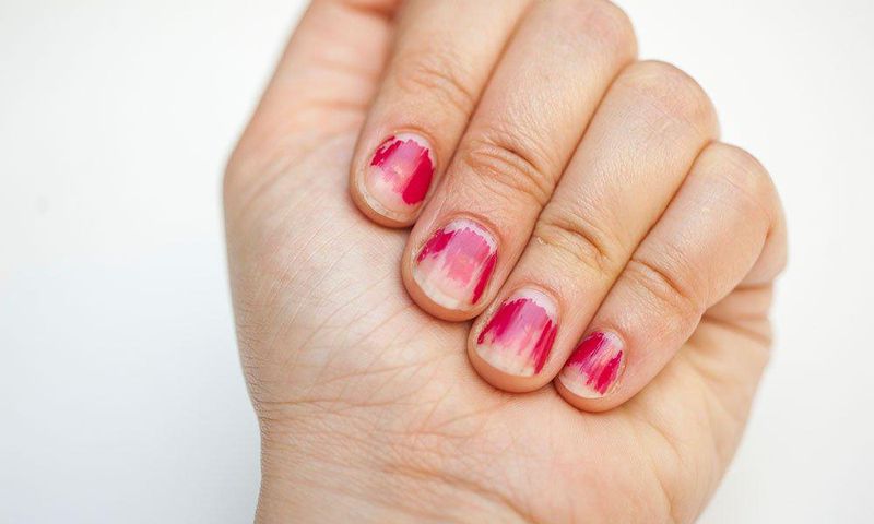 ___7013054___https:______static.pulse.com.gh___webservice___escenic___binary___7013054___2017___7___18___23___chipped-manicure