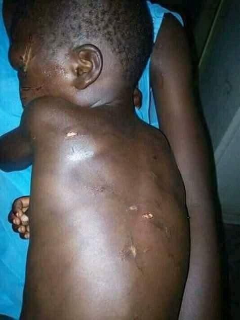 Stepmother brutalises little boy, photos will shake you