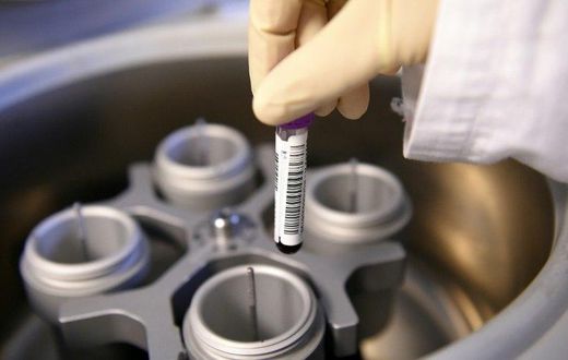 Russia was accused in a World Anti-Doping Agency report of widespread state-sponsored doping