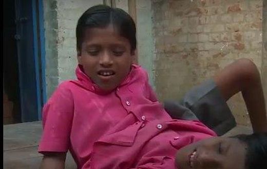 Nobody should dare separate us! – Conjoined twins warn (Video)