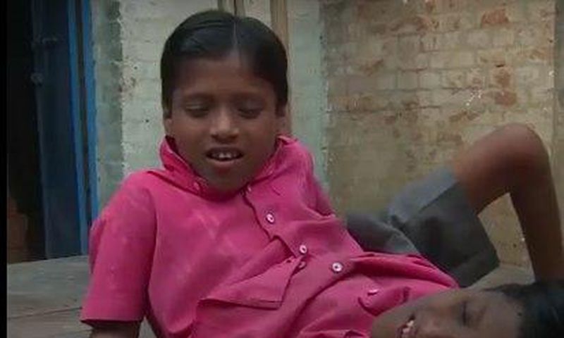 Nobody should dare separate us! – Conjoined twins warn (Video)