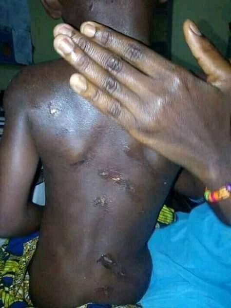 Stepmother brutalises little boy, photos will shake you