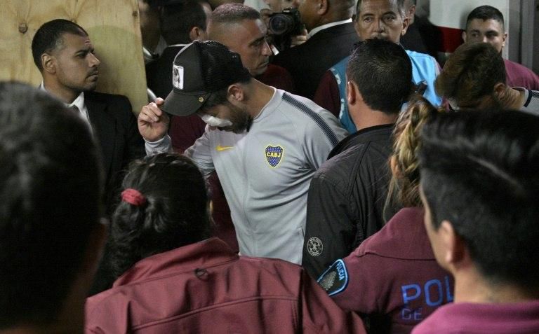Boca Juniors captain Pablo Perez needed treatment to an eye injury after the bus attack