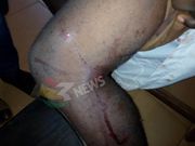 Salaga SHS teacher shoots at students; leaves one critically injured