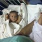 Tofa and Tahura, ten-month-old twins who were born conjoined at the spine and rectum, were separated by a team of two dozen doctors Tuesday in Dhaka