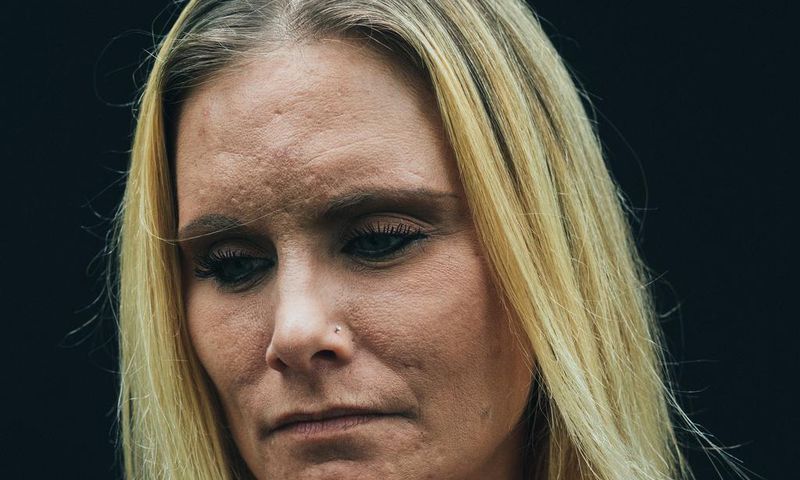 How Do You Recover After Millions Have Watched You Overdose?