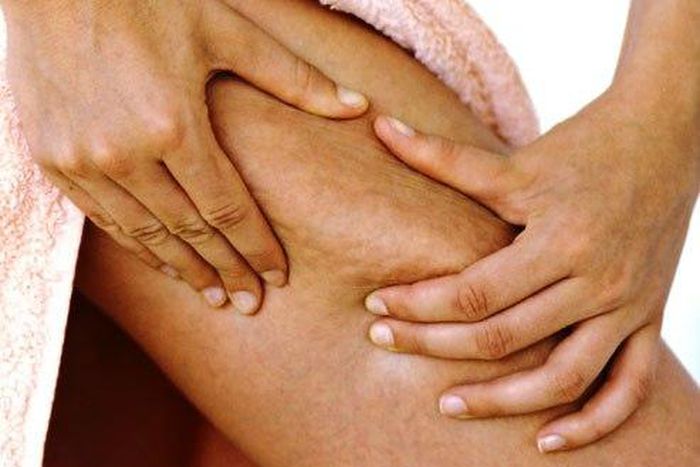 ___6995281___https:______static.pulse.com.gh___webservice___escenic___binary___6995281___2017___7___14___19___photolibrary_rm_photo_of_woman_pinching_cellulite