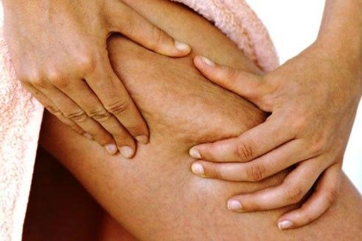 ___6995281___https:______static.pulse.com.gh___webservice___escenic___binary___6995281___2017___7___14___19___photolibrary_rm_photo_of_woman_pinching_cellulite