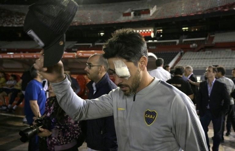 Boca Juniors captain Pablo Perez suffered an eye injury when his team's bus came under attack from River Plate fans
