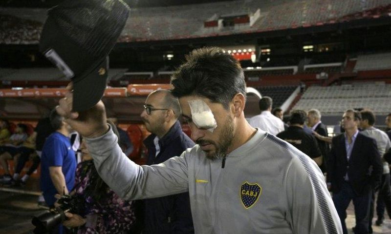 Boca Juniors captain Pablo Perez needed hospital treatment after the attack on his team's bus