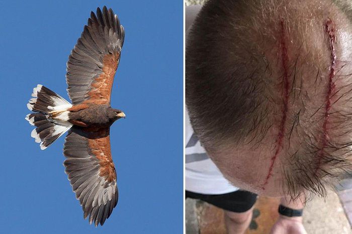 man attacked by hawk jogging